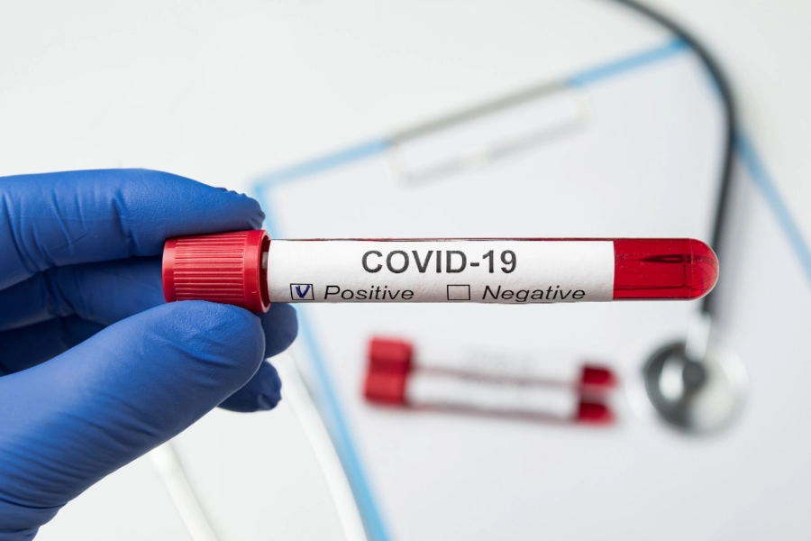 врач в держит пробирку в руке для теста на коронавирус