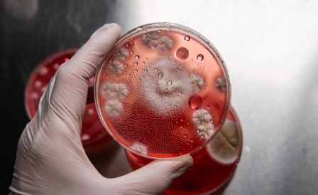 подробная картинка хламидиоза