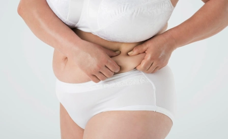 фото девушки с метаболическим синдромом