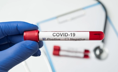 врач в держит пробирку в руке для теста на коронавирус