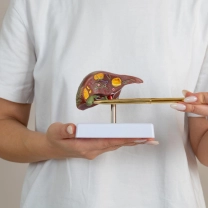 врач показывает макет печени