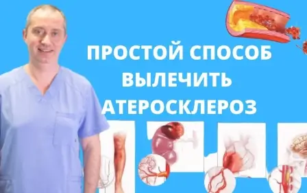 Как вылечить атеросклероз?