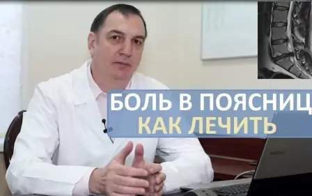 Острая боль в пояснице: как лечить. Грыжа диска, люмбаго, ишиас, радикулит.