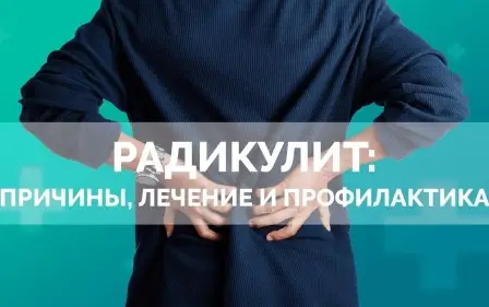 Радикулит: причины, лечение и профилактика