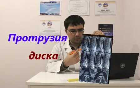 Протрузия диска: что это такое, как лечить протрузию?