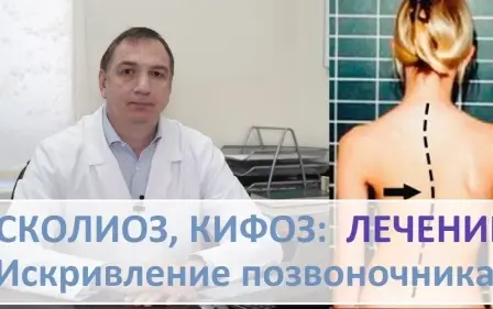 СКОЛИОЗ, кифоз, ЛЕЧЕНИЕ. Искривление позвоночника. Какую гимнастику нужно делать.